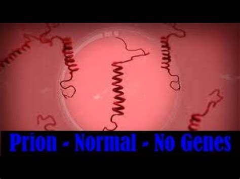 how to beat prion on normal